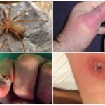 Consequence of a hermit spider bite