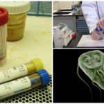 Analysis of feces on Giardia
